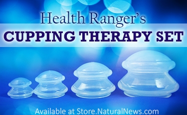Cupping-Therapy-Set-AD.jpg