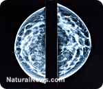 http://www.naturalnews.com/gallery/articles/BreastCancer-Imaging.jpg