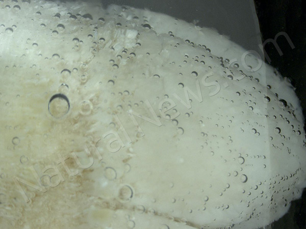 O ácido fosfórico usado em refrigerantes mostrado dissolução dentes raro vídeo Teeth Acid Bath 110 600