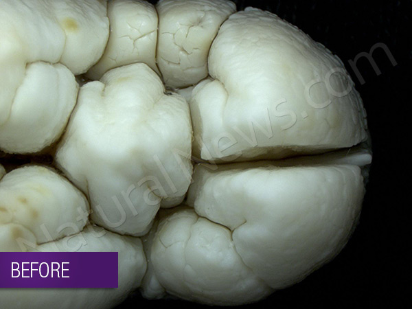 O ácido fosfórico usado em refrigerantes mostrado dissolução dentes Dentes vídeo raro antes dos 100 600