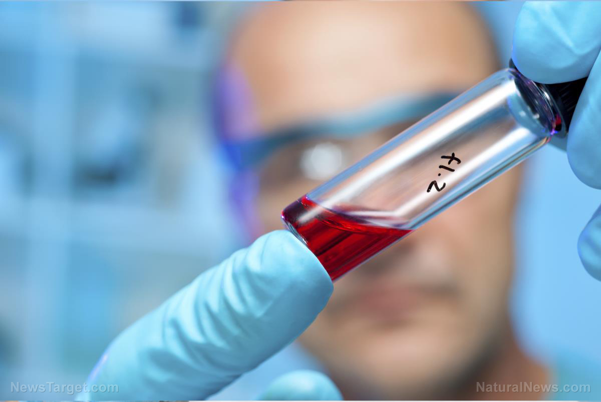 Science-Lab-Sample-Blood-Test.jpg