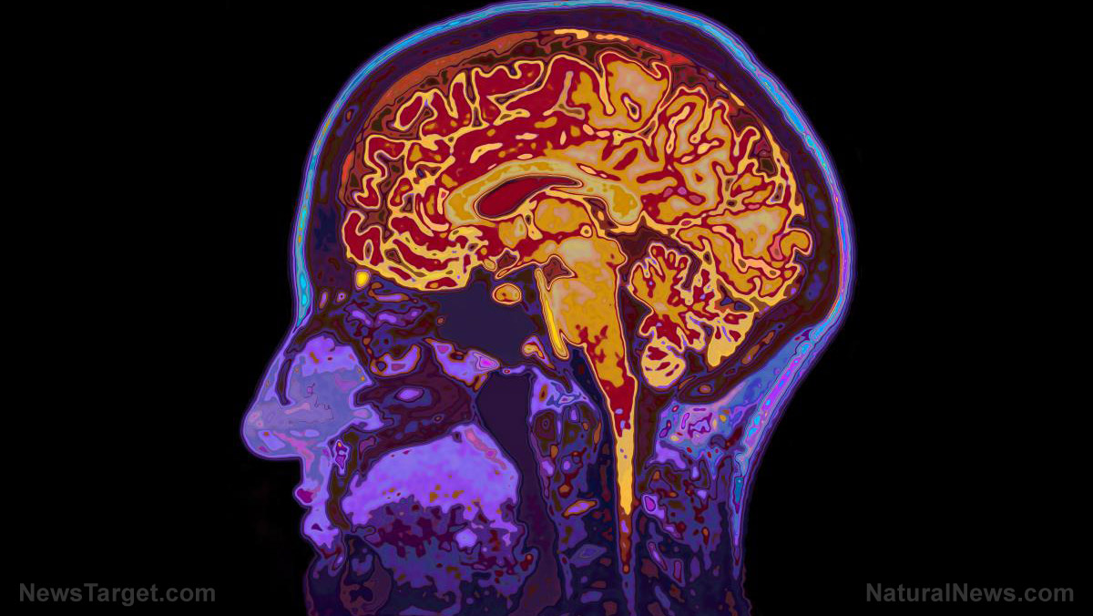 Mri-Image-Head-Showing-Brain.jpg