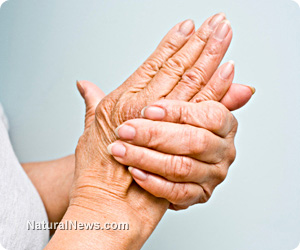 Strong Link Found Between Rheumatoid Arthritis And Vitamin D