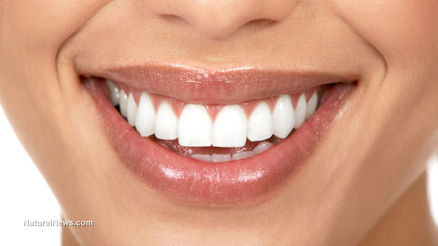 Teeth whitening