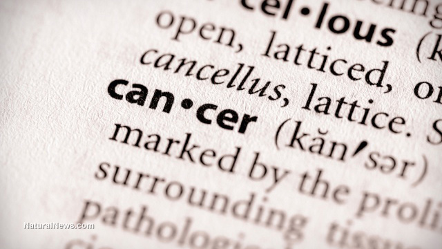 Cancer detection