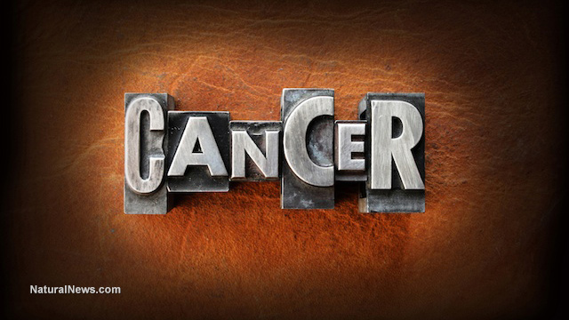 Cancer causes