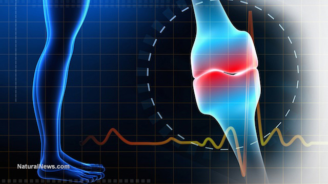 P R O L I A Denosumab Treats Osteoporosis Bone Cancer and BoneRelated Problems in Patients who have Cancer