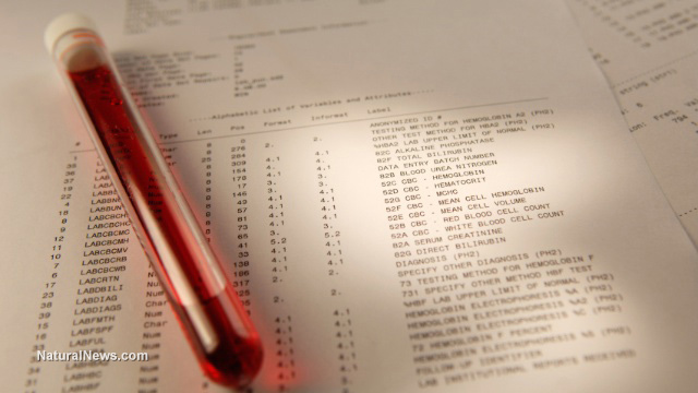 Glyphosate testing