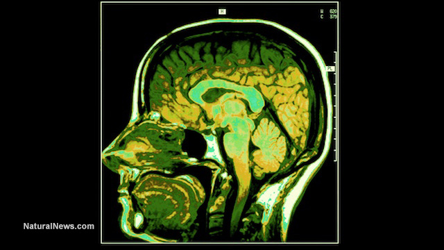 Antipsychotic drugs