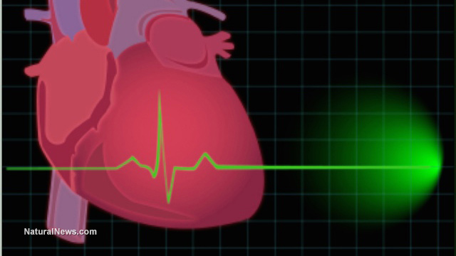 Atrial fibrillation