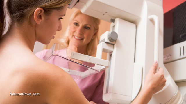Mammogram guidelines