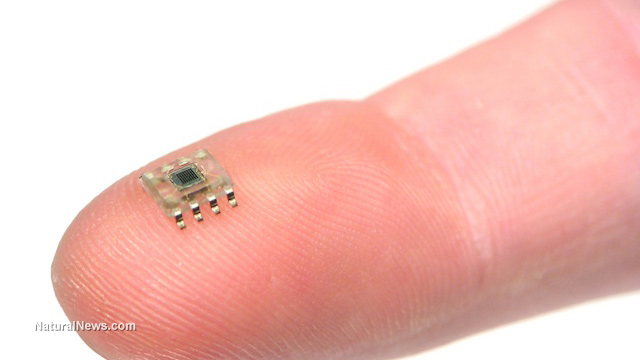 Microchip implants