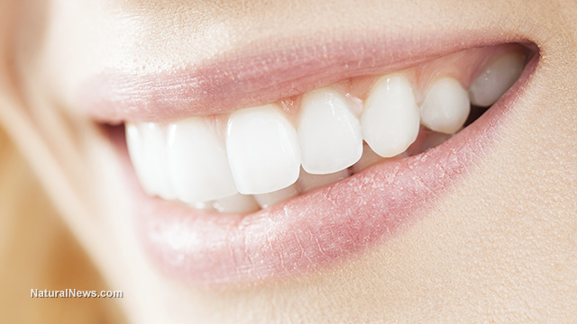 Teeth whitener