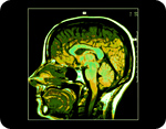 CT scans