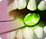 Mercury fillings