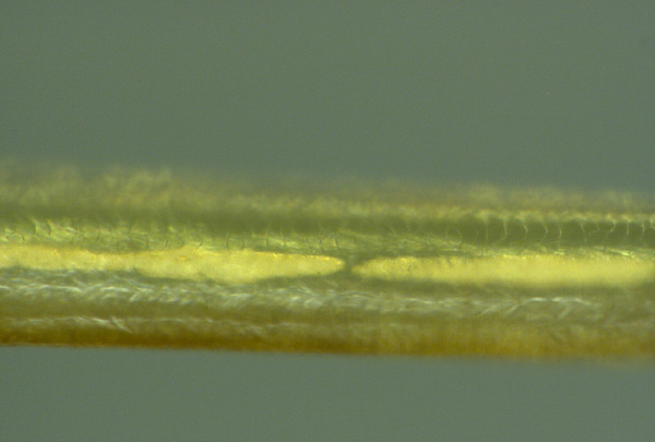 Nanowire-clot-1000x-2.png.png