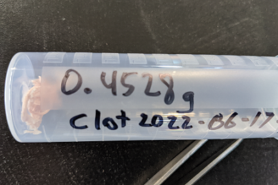 Clot-sample-prep-vial-400.png