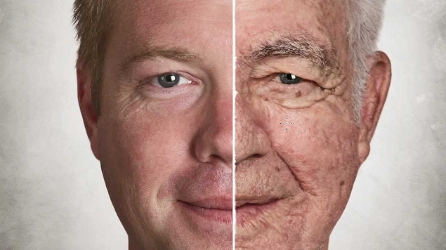Aging2