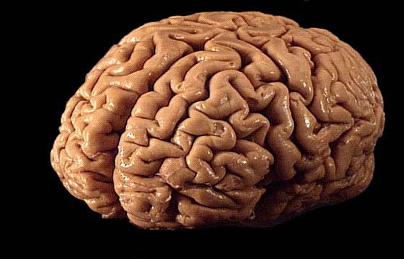 Scientists are growing hundreds of human brains for testing.
