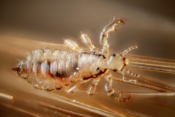 Image: Poisoned: Toxic head lice treatment linked to alterations in behavior