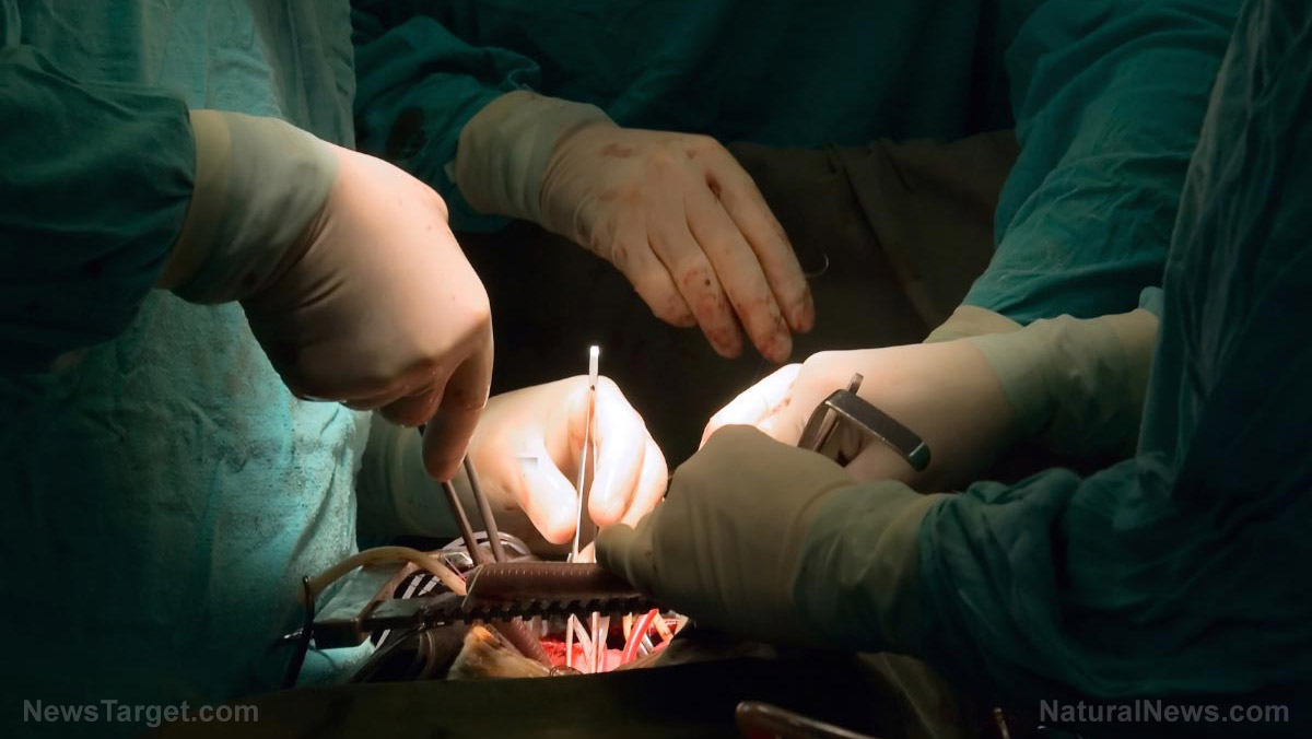 Image: 1 out of 200 kidney surgery recipients DIE in just 30 days after the procedure, new study warns