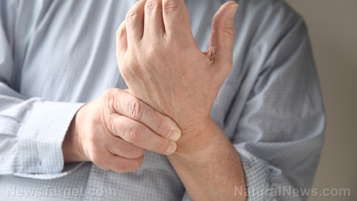 Image: Pycnogenol shown to ease arthritis, according to new study