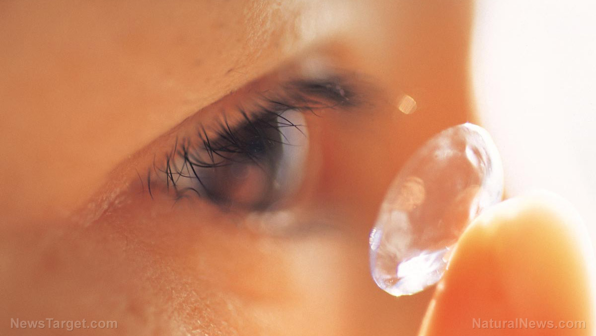 Image: WEIRD: Cataract surgery patient has 27 contact lenses removed from her EYE
