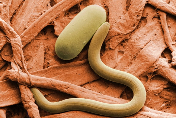 Image: Creepy life-threatening parasites straight out of science fiction – only they’re real: Tips for avoiding these 6 nightmares