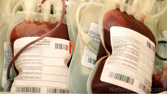 Image: Blood transfusion danger: Donations by pregnant women increase mortality in men