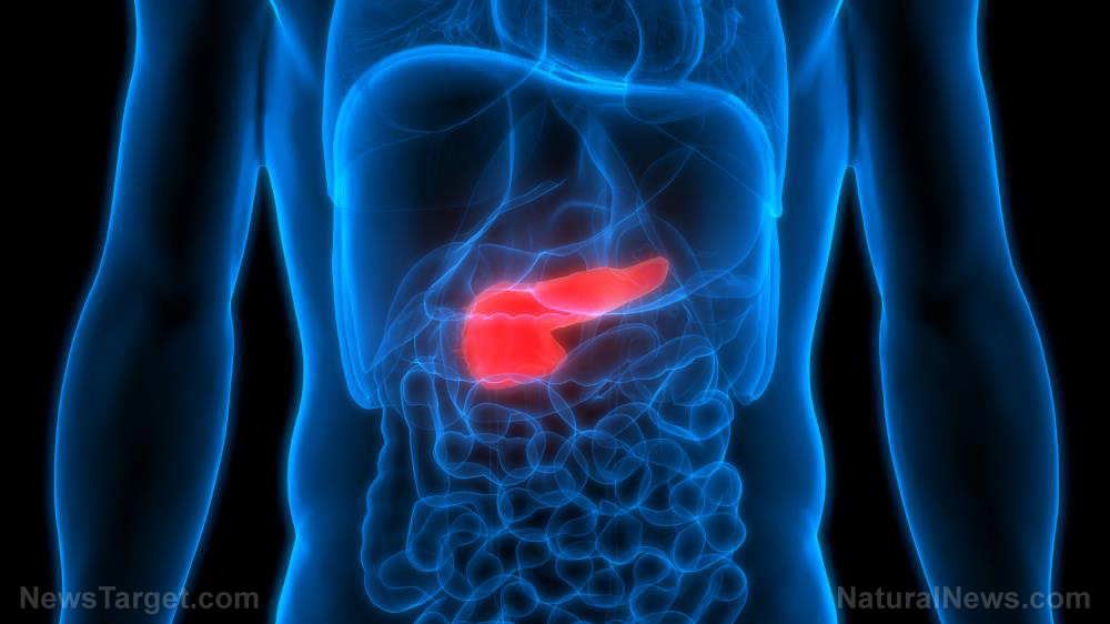 Image: Scientists study an alternative approach to treating pancreatic cancer