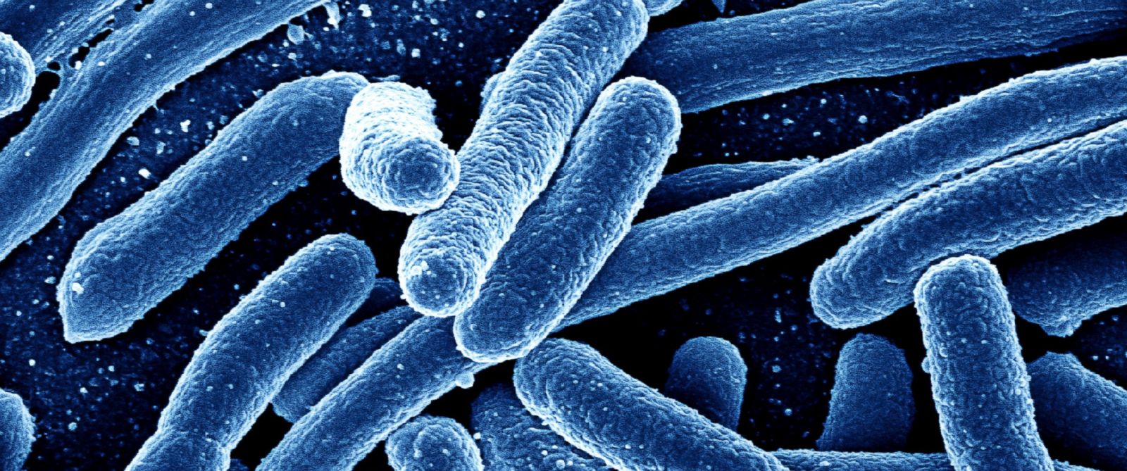 Image: Health authorities warn next superbug pandemic will kill â€œmillionsâ€ â€¦ and nations arenâ€™t doing anything to stop it