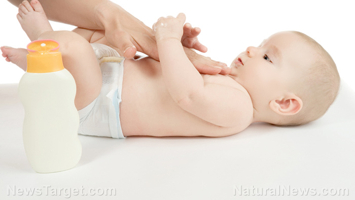 Image: Treating eczema and dermatitis in infants