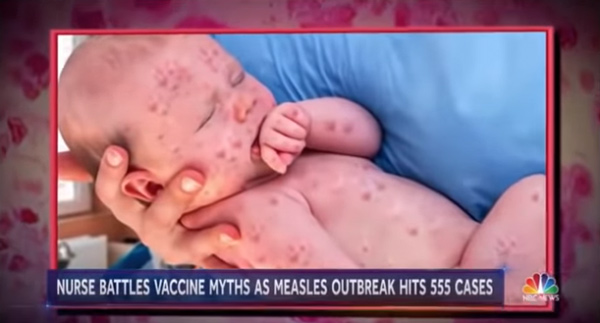 NBC-News-Measles-Photoshop-Baby.jpg