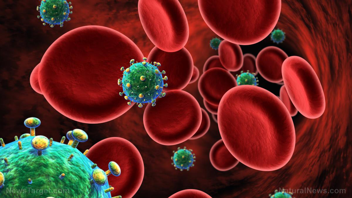 Image: Les allégations d'une nouvelle variante plus mortelle du VIH pourraient être une tentative d'effrayer les gens pour qu'ils acceptent une autre pandémie