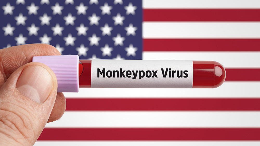 Monkeypox detected in at least 11 countries; scientists claim to be puzzled over its spread - Vimarsana News