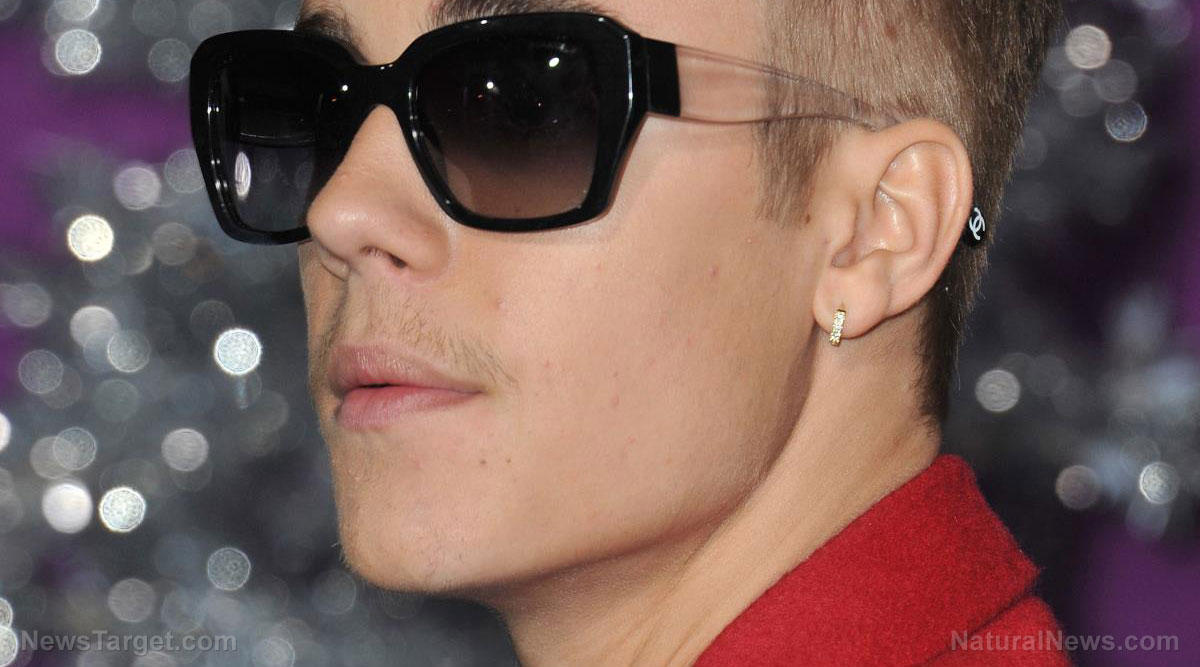 Immagine: il viso di Justin Bieber è paralizzato dalla sindrome di Ramsay Hunt, una nota reazione avversa delle iniezioni di covid