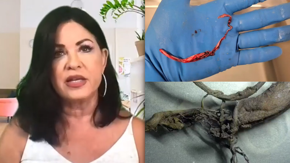 Image: Mike Adams full broadcast on the Alex Jones Show, June 13th, 2022, featuring an urgent care doctor, embalmer Richard Hirschman and Dr. Jane Ruby, plus live microscopy of biostructure “clots” that are killing people
