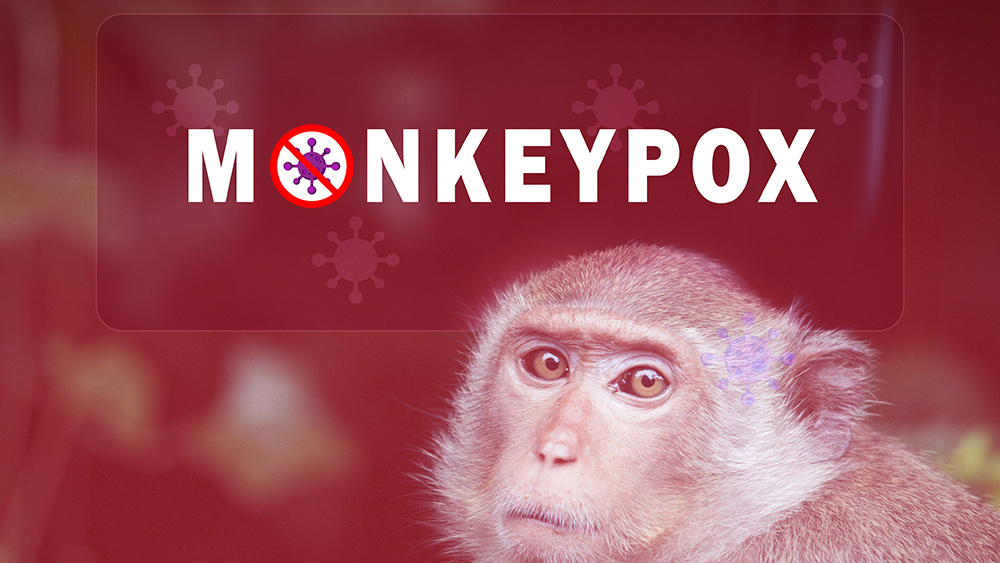 Image: “Official” health authorities caught lying about monkeypox
