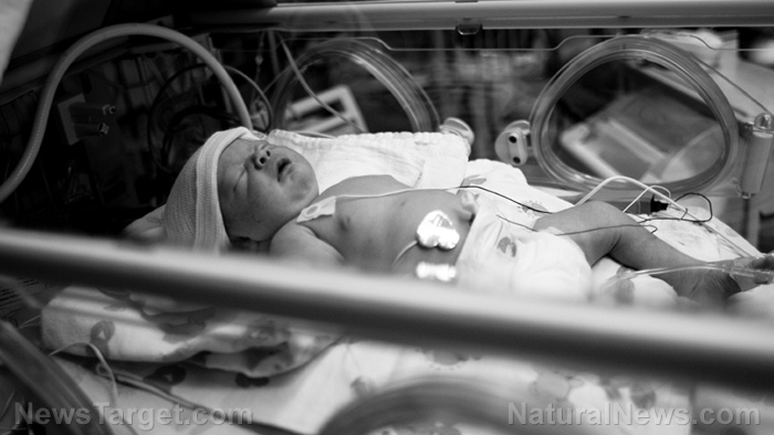 Le bras d'un nouveau-né AMPUTÉ après que maman ait pris des vaccins covid et que le bébé ait souffert de caillots sanguins dans l'utérus