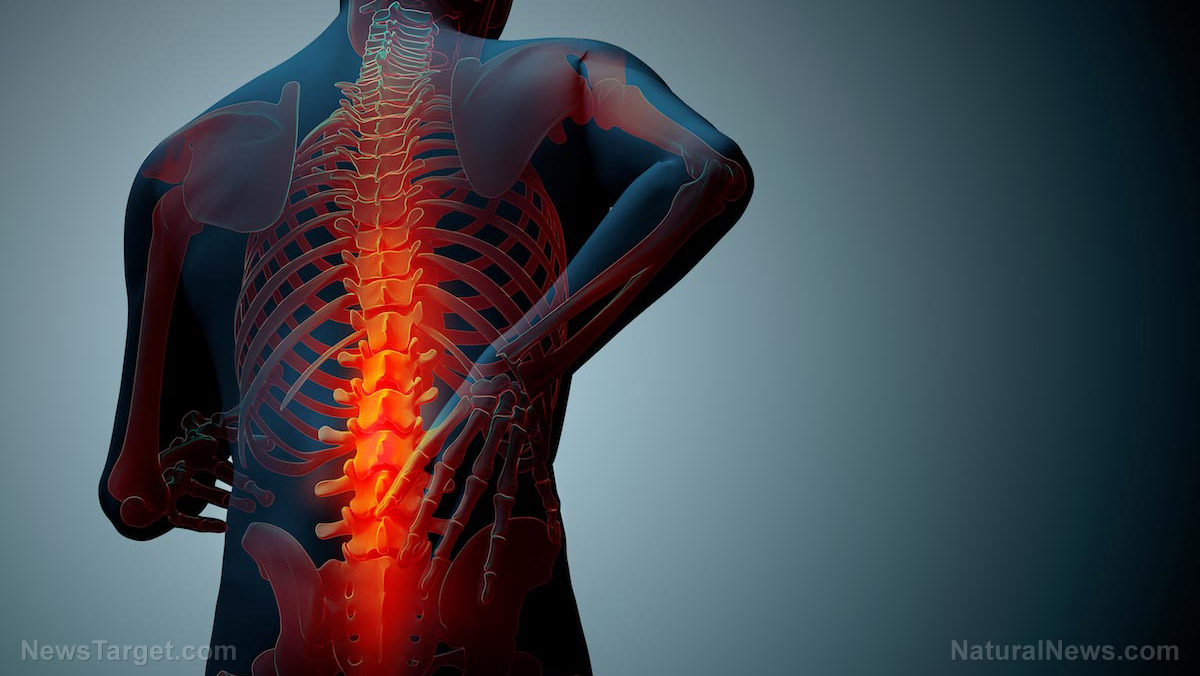 une carence en Vitamine D provoque la douleur au bas du dos chez les femmes ménopausées, étude suggère