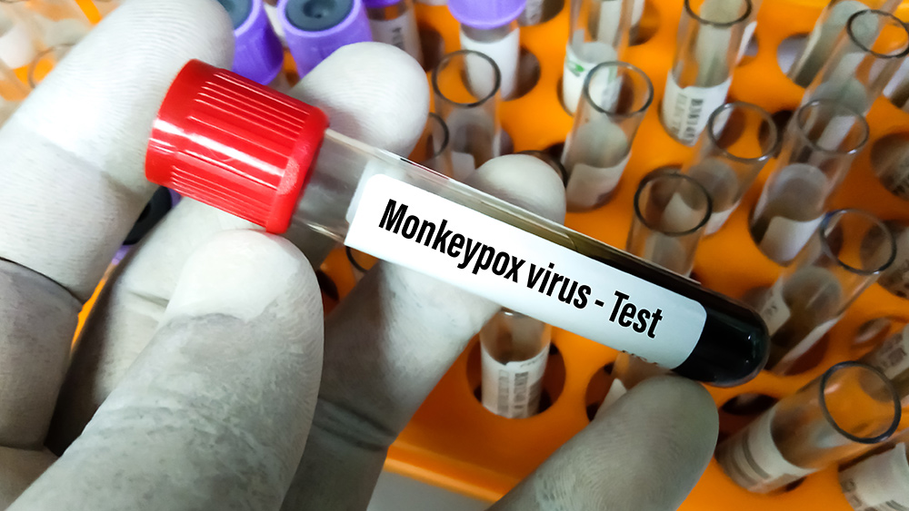 Image: “Monkeypox” is only circulating in countries where the Pfizer Vaccine has been distributed & is being used to advance a Technocratic Great Reset