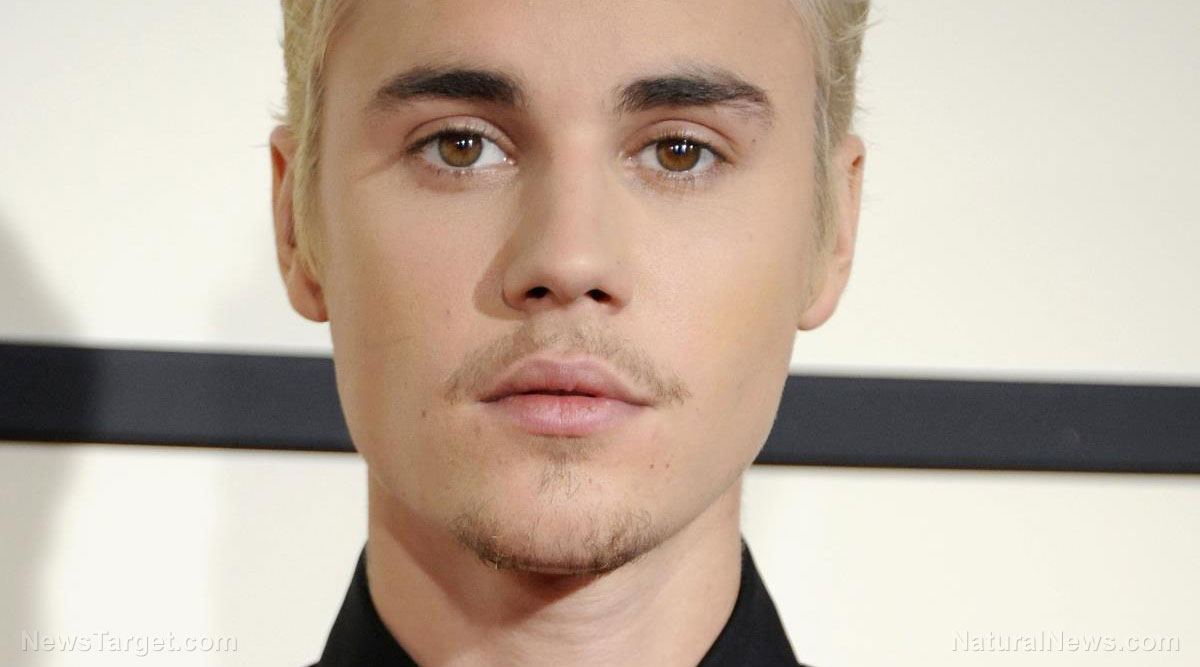 Immagine: Justin Bieber: la paralisi facciale è una 
