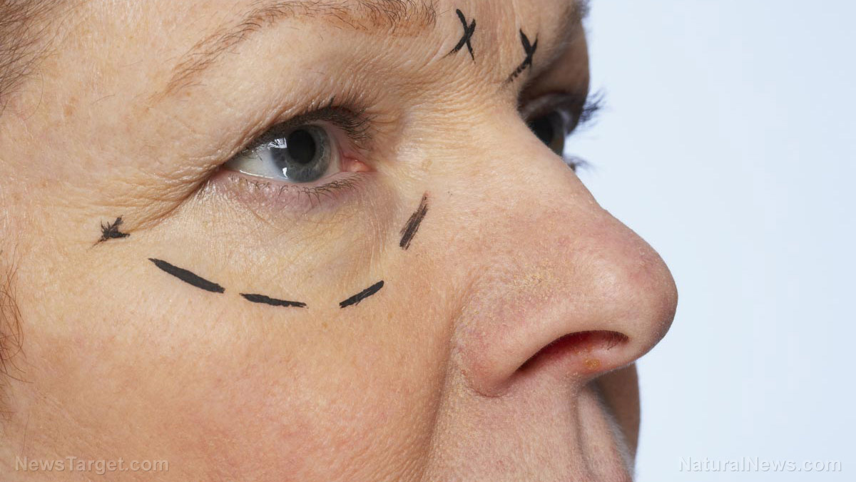 Image: Patient PERMANENTLY LOST eyesight following botched facial feminization surgery