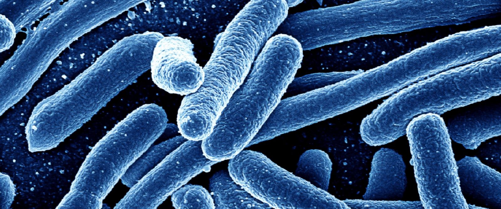 Image: Antidepressants linked to rise in superbugs, study finds