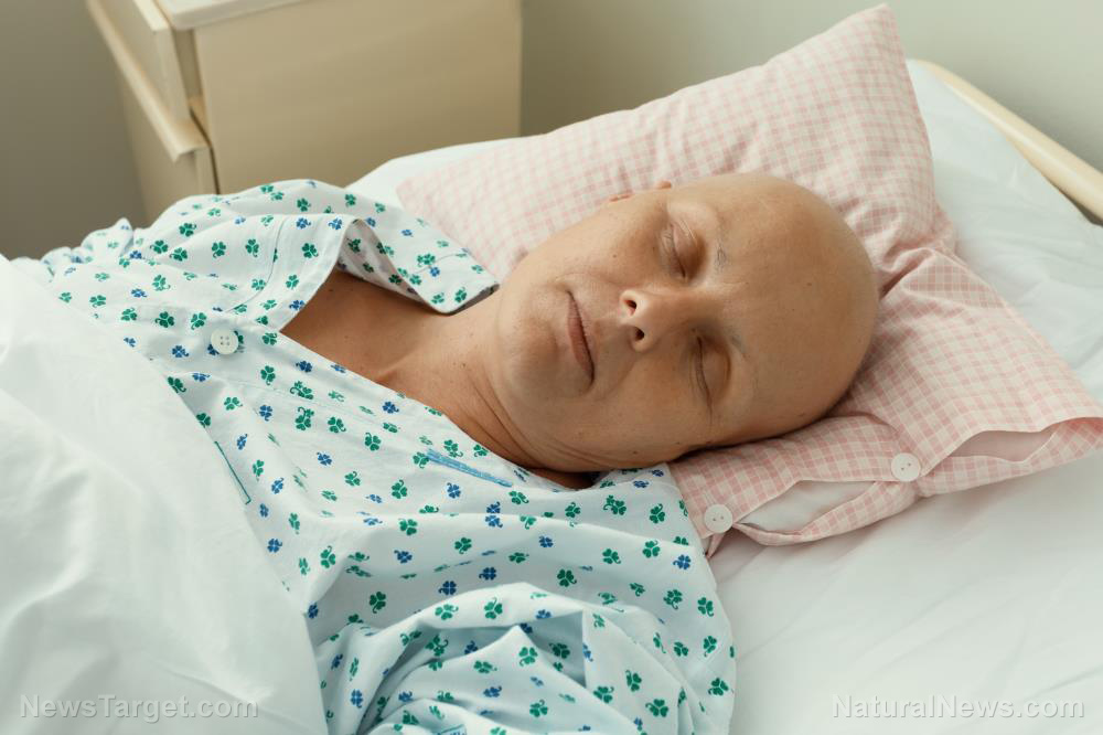 CHEMOTHERAPY causes permanent HEART DAMAGE – NaturalNews.com CHEMOTHERAPY causes permanent HEART DAMAGE – NaturalNews.com