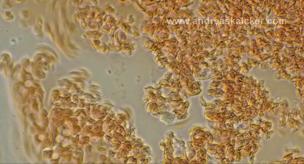 “Beyond The Diagnosis” on BrightU: The powerful microbicide properties of chlorine dioxide